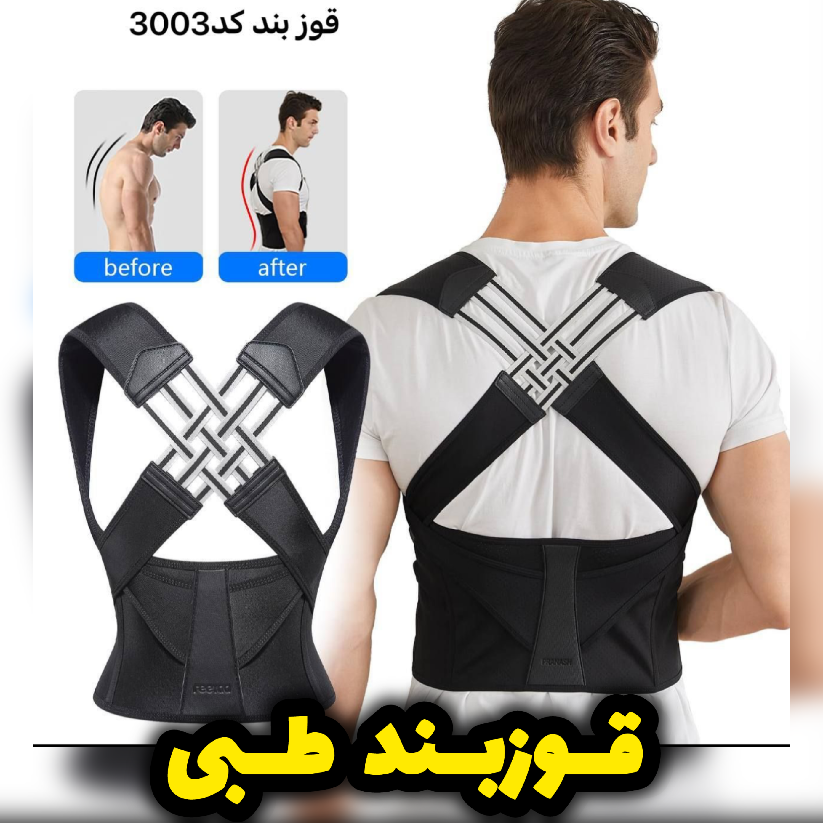 قوزبند طبی اصلاح فرم بدن